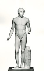 Kasseler Apollon, Kassel MHK Antikensammlung Sk 3 (Zustand seit 1974)
